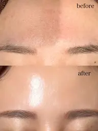 全ての肌悩みに強力アプローチ【CHRISTINA】アンストレス＋ローズドメーラ組み合わせ施術🕊️💎