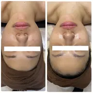 スッキリ小顔‼️(ヘッドマッサージ付き)