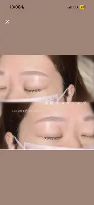 美眉ワックス脱毛