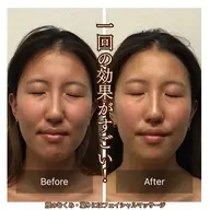 【ミニモ限定価格🎫】気になる顔の凝りにスッキリフェイシャルマッサージ60分✨💆🏻‍♀️