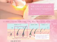 おまたカウンセリング付きVIO脱毛