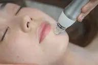 【都度払い】【勧誘なしで安心】毛穴スッキリ集中ケア💎毛穴洗浄ハイドラ × ダイヤモンドピーリング