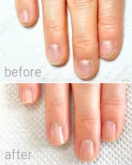 自爪育成《最強のネイルケア3ヶ月コース》1回お試し体験◎噛み爪/むしり癖/深爪/貝爪/平らな爪/二枚爪
