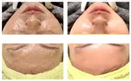 【ハリ・キメ・くすみ・むくみ】 2段階保湿で潤いと透明感を✨【フェイシャル】