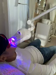 セルフホワイトニング　10分照射