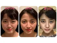 美小顔フェイシャル【新規限定】