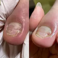 深爪・噛み爪・トラブルケア、爪の矯正 カウンセリング込み。どんな小さいお悩みでも一度ご相談ください。