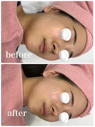 【ミニモ限定✨小顔ケア】EMSフェイスラインスッキリ¥2,500