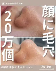 ミニモ学割✨🍓いちご鼻集中ケア🍓30分のクイックケア✨気になる黒ずみを徹底ケア✨