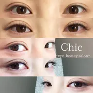 100本カウンセリング込