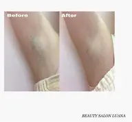 【全身シェービング(カオ込み/VIOなし)】¥10000 医療脱毛前、旅行、イベント前にも◎