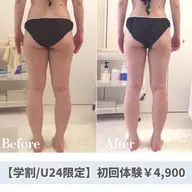​🉐【ミニモ学割/U24】トリプル溶解痩身45分✨美脚・くびれ・二の腕・ハミ肉など気になるところを集中ケア✨