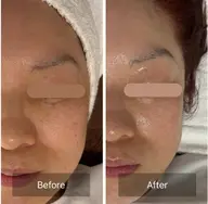 【たるみ.シワ悩み】オールハンドフェイシャル