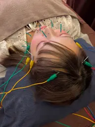 【当日限定】 冷えた体に🎀美容鍼➕ホットストーンセラピー🎀