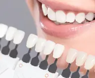 プレミアムホワイトニング1セット|初回体験