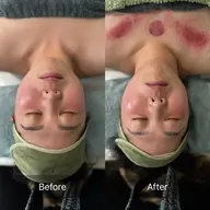 【80分 フェイシャルかっさ 至福のひととき】クレンジング〜マッサージ〜パック〜整肌 ¥8,900