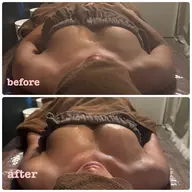 【ミニモ限定】1度で効果実感✨プレミアム光育乳コース🩷