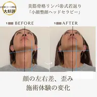 たるみ！えらはり！顔の歪み撃退！無痛の若見え小顔整顔ヘッド！新感覚！全身骨格調整×深層リンパ×小顔整顔