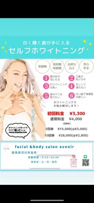 歯のセルフホワイトニング