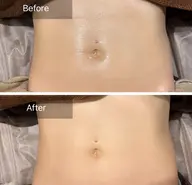 【温活×腸活】よもぎ蒸し40分+腸もみ40分