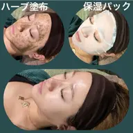 平日限定!!剥離なし ハーブピーリング