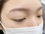 【アイブロウWAX脱毛】眉毛脱毛