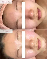 4/1空き◎プレミアム艶肌Wax✨毛穴洗浄＋ワックスでツヤ肌へ導く極上ケア☆産毛・角質・皮脂をごっそり‼️