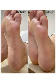 【ガサガサかかとにバイバイ👋】フット角質ケア ＆ スクラブマッサージ✨