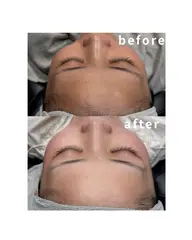 【プレミアムシェービング】クレンジング＋顔シェービング（眉込み）＋リフトアップマッサージ＋酵素パック＋ACパック