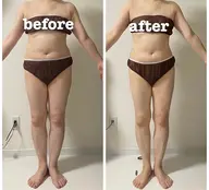 【痩身】【全身】最高級マシン！切らない脂肪吸引！ZERO CRASH