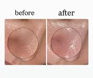 人気No.1 🌿美眉スタイリング＋毛穴洗浄・ニキビ鎮静