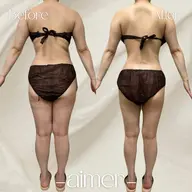 [ミニモ学割]U24限定‪‪❤︎‬全身‪‪❤︎‬ハイパーナイフ90分