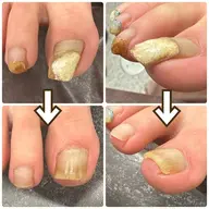 フットバス・爪切り・爪周り＆角質ケア・たこ＆魚の目ケア・巻き爪ケア (ジェル・ポリッシュなし)