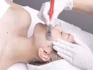 【全ての毛穴悩み/シミ】120分⭐️肌の角質ケア+IPL⭐️韓国で人気 肌質ケアの定番