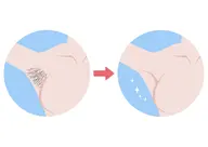 夏に向けオススメ✨🚺【女性】脇のみ徹底‼️ハイスピード脱毛