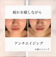 🥉小顔リフトアップコース50分