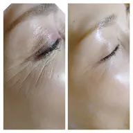 《REVIハーブピーリング》シワ、たるみケア☆シルク2ｇ+パワーローズブースタ+CYリキッド☆¥4400相当プレゼント☆