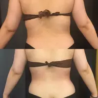 【痩身】当店人気No.1痩身🏅サーモシェイプDeepでスッキリ美Body🔥