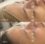 《紫外線対策!バリア機能強化♪2月限定クーポン》¥17,050→¥13,750