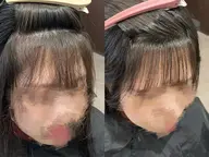 顔まわり&前髪カット ➕顔まわり弱酸性縮毛矯正