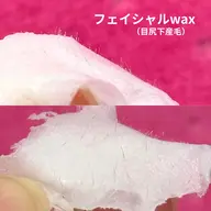 フェイシャルwax脱毛