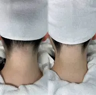 【 うなじ脱毛+シェービング 】後ろ姿美人へ🦢🏹