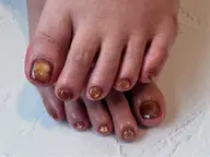 (マグネット・フラッシュ・ミラー)フットネイル