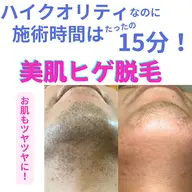 【メンズ】美肌効果あり！美肌ヒゲ脱毛★（美容液たっぷりパックつき）SHR光脱毛