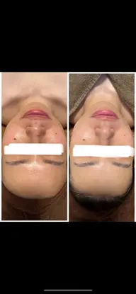 フェイシャル.デコルテマッサージ（エイジングケア込み）🌿