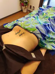 【鍼灸施術】しぶとい肩凝り、腰痛、眼精疲労等のお悩みを解消😊