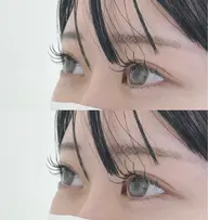 フラットラッシュ付け放題【100 ~140本】