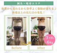 『全身たっぷりまるごとキャビ100分❤︎』全部位キャビテーション❣️老廃物の排出を促すため爪先から首までリンパケアも♪