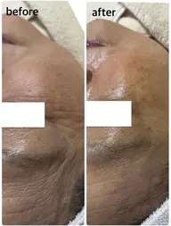 ハリ、美白がほしい方〉〉〉３Ｄスフィア