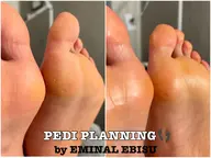 🐬🫧‪つるつる足裏🤍韓国式足裏角質ケア👣⸒⸒ペディプランニング🎐🩵🫧𓈒𓏸🪽《フットケア》